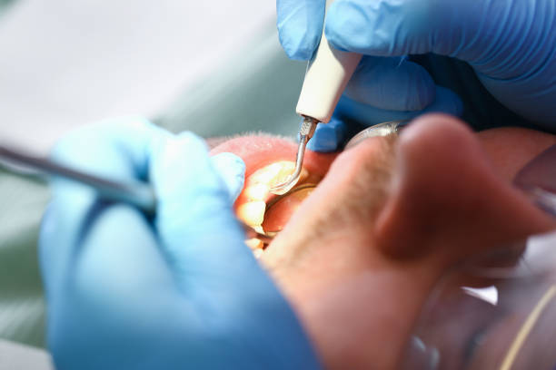 Best After-Hours Emergency Dentist in Fobes Hill, WA